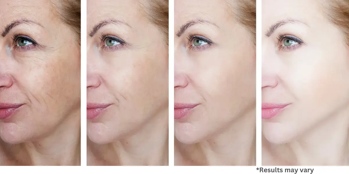 Renovare Pro before/after